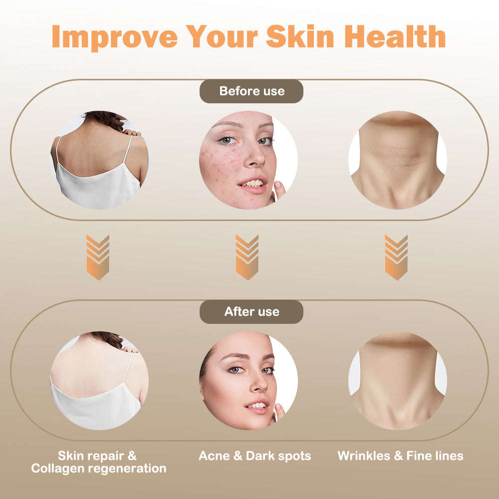 LED Photon Therapy Skin Rejuvenation Splashis acne-treatment adjustable-intensity adulting-done-right advanced-skincare affordable-luxury all-skin-types anti-aging-mask anti-wrinkle-device at-home-facial award-winning beauty-editor-pick