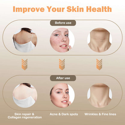 LED Photon Therapy Skin Rejuvenation Splashis acne-treatment adjustable-intensity adulting-done-right advanced-skincare affordable-luxury all-skin-types anti-aging-mask anti-wrinkle-device at-home-facial award-winning beauty-editor-pick