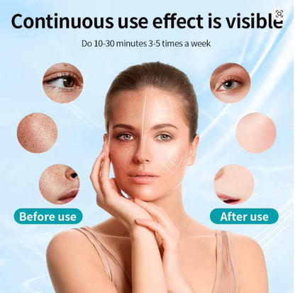 Multi-color LED photon skin rejuvenation Splashis accessible-technology acne-fighting acne-scar-treatment acne-treatment adjustable-mask adult-acne affordable-luxury age-eraser age-spot-reducer ageless-beauty all-skin-tones all-skin-types