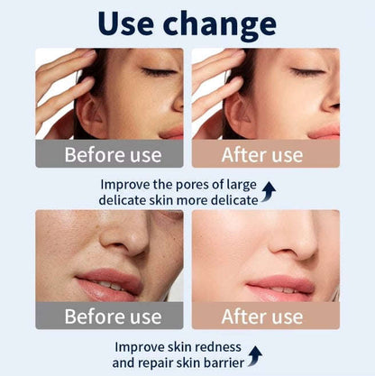 Multi-color LED photon skin rejuvenation Splashis accessible-technology acne-fighting acne-scar-treatment acne-treatment adjustable-mask adult-acne affordable-luxury age-eraser age-spot-reducer ageless-beauty all-skin-tones all-skin-types